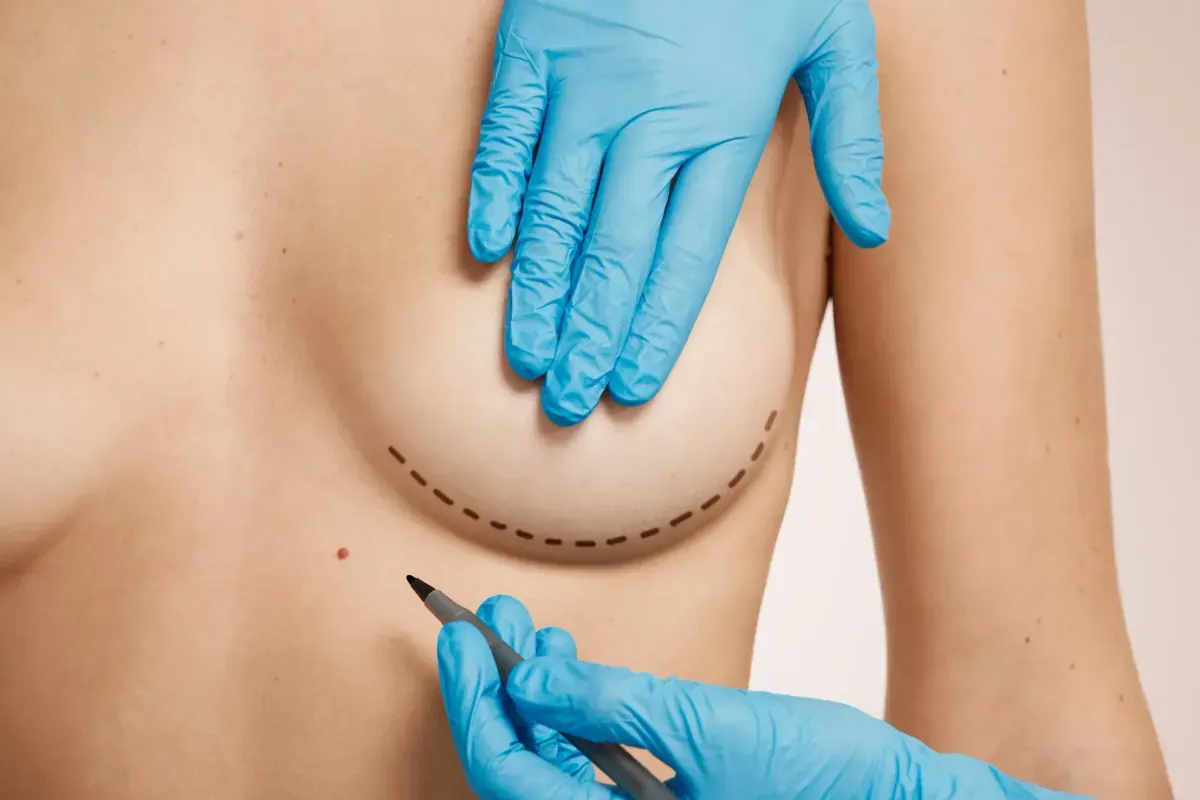 Breast Firming (Mastopexy / Breast Lift)