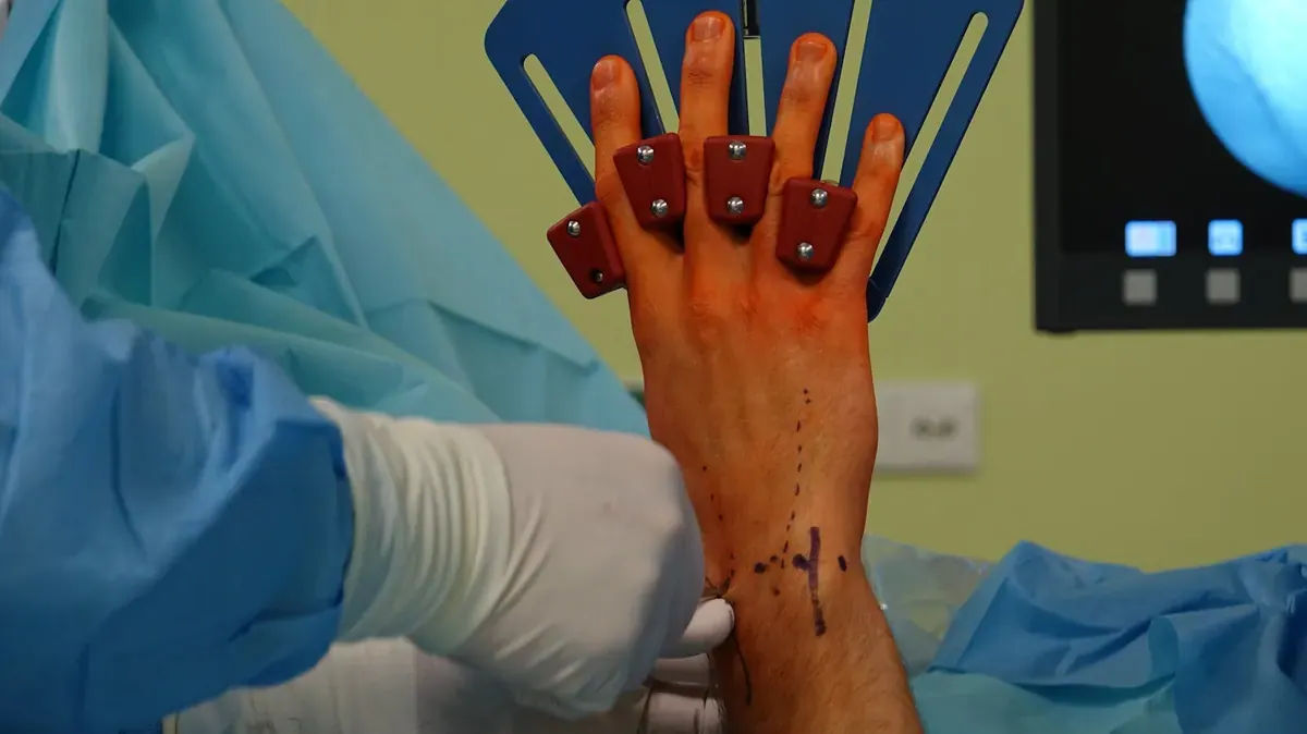 Nerve, Tendon & Bone Surgery in Aligarh — Dr. Amit Agrawal
