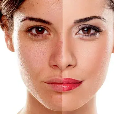 Total Facial Renewal