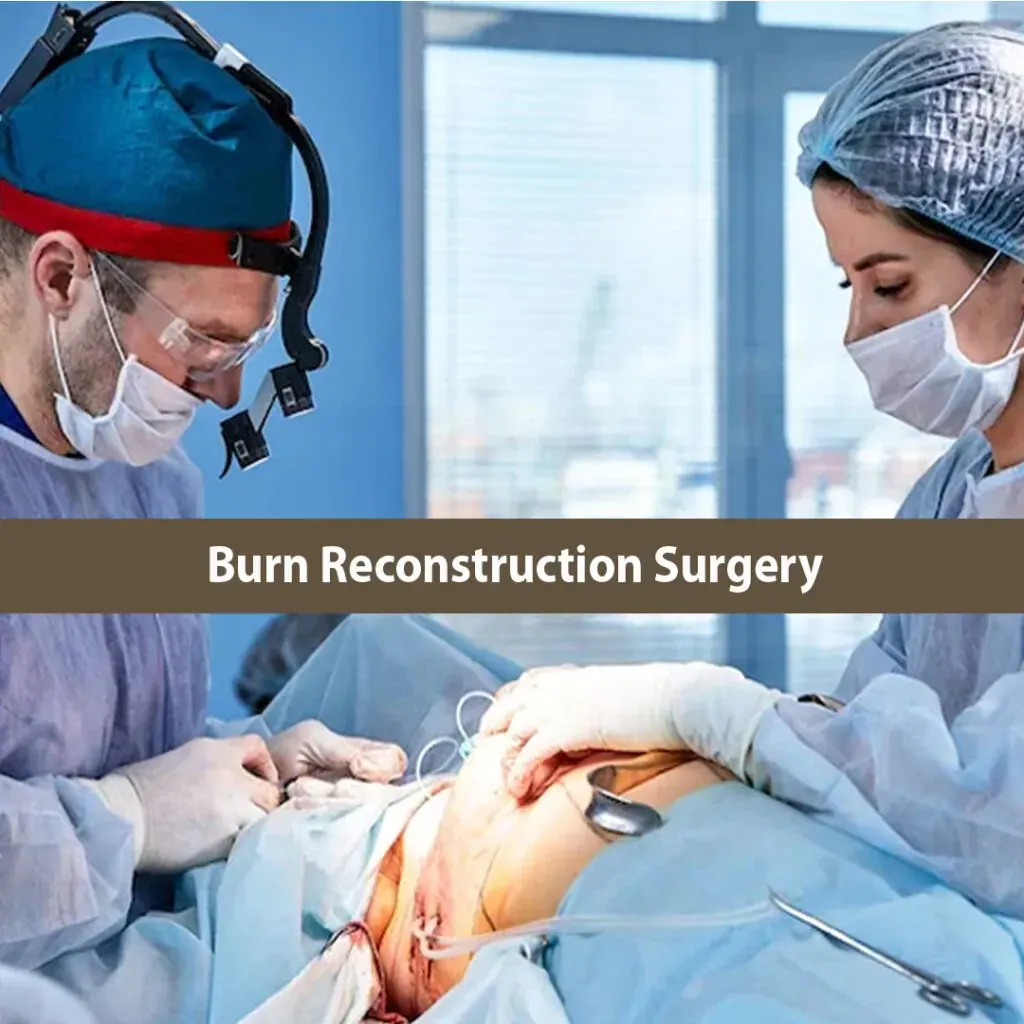 Burn Reconstruction