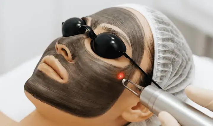 Chemical Peels