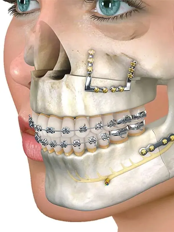 Deformity Correction in Aligarh — Dr. Amit Agrawal