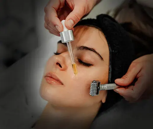 Microneedling