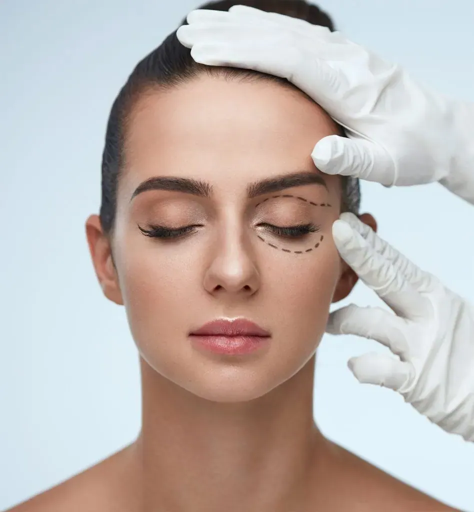 Blepharoplasty