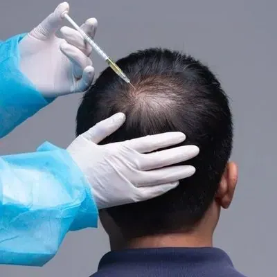 Hair Loss Treatment