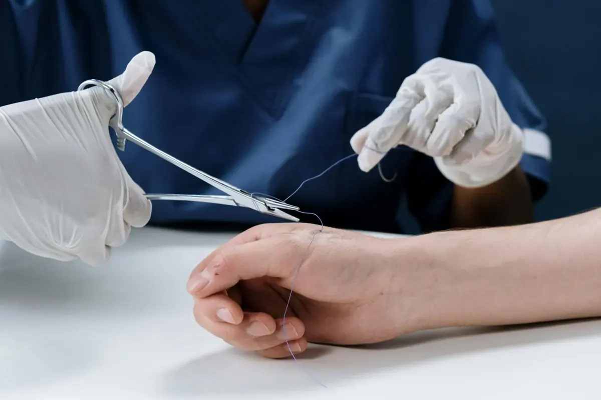 Hand Surgery