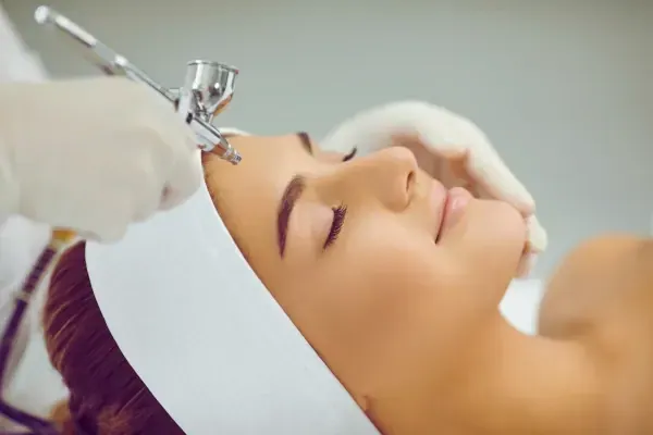 Microdermabrasion
